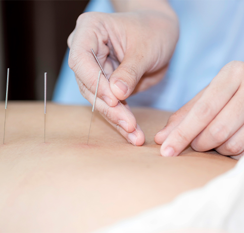 Home 3 acupuncture-vancouver-kimberly-de-matos-skin-care-studio