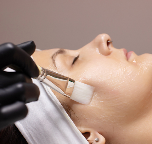 Home 2 skin-peels-vancouver-kimberly-de-matos-skin-care-studio